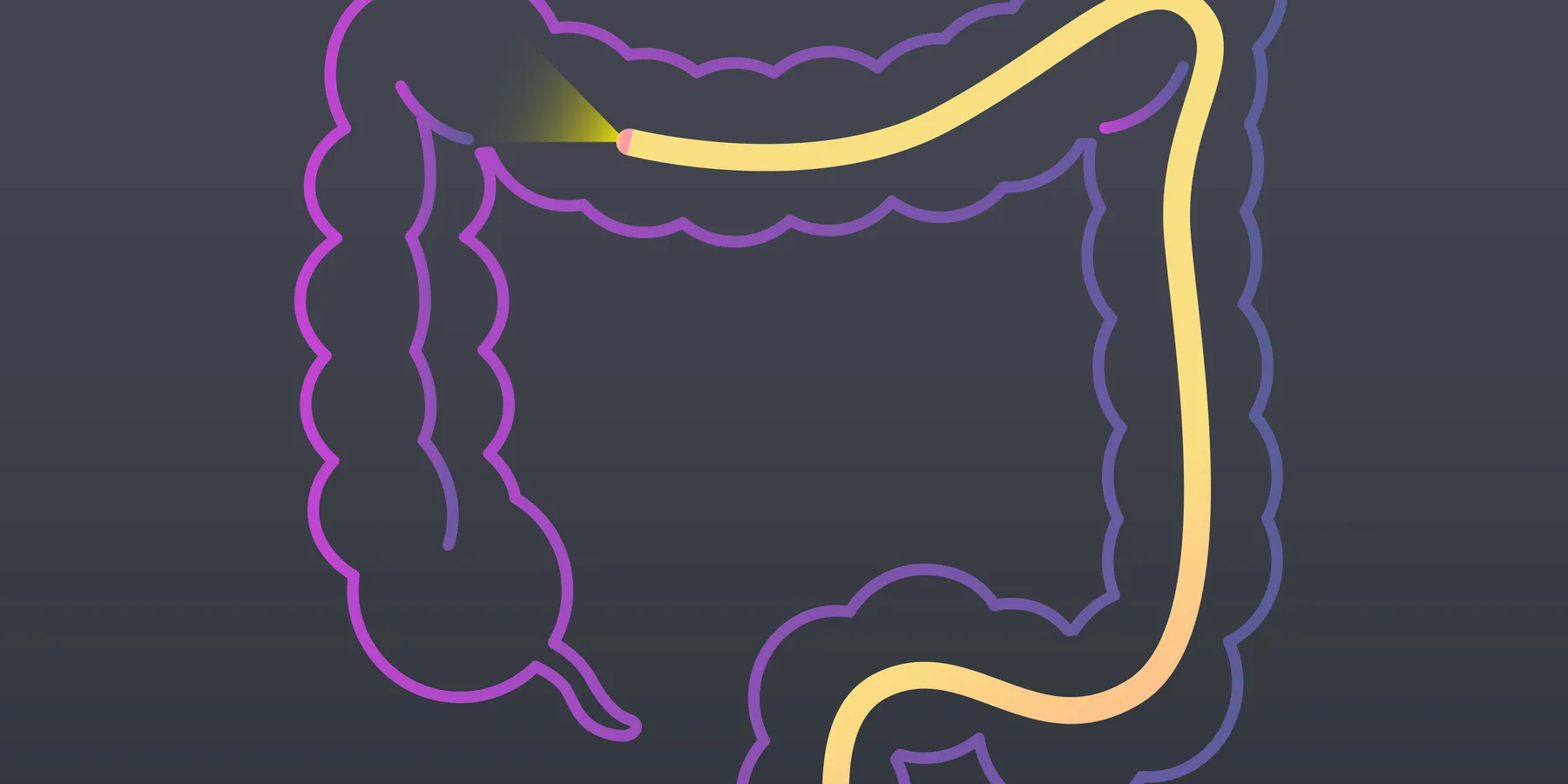 colonoscopy