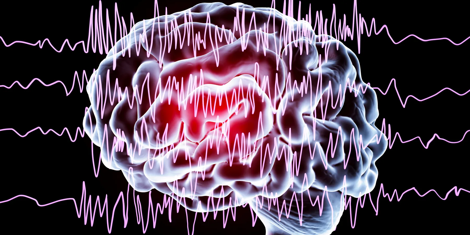 neuromodulation