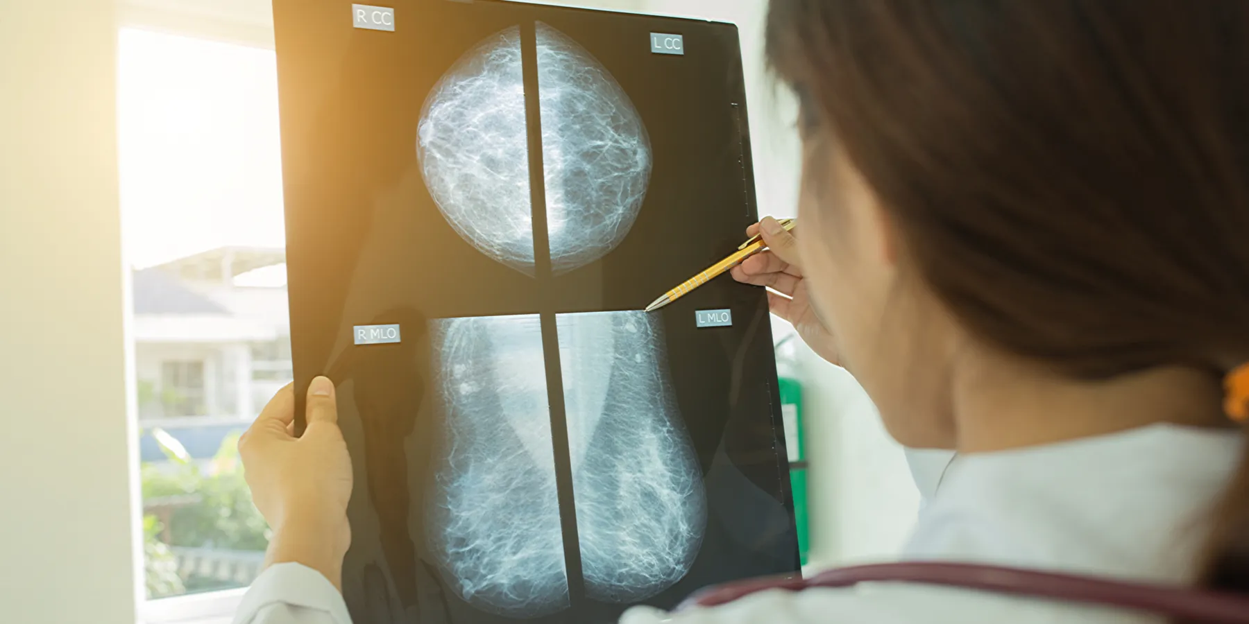breast cancer care