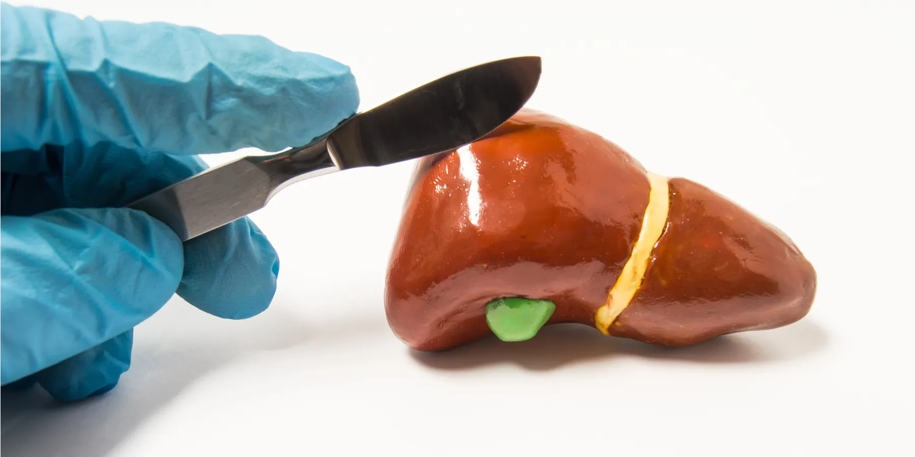 Rationing livers