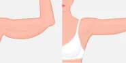 plastic surgery