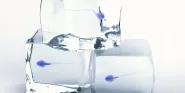 infertility